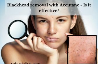 Blackhead removal with Accutane - Is it effective