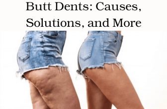 Butt Dents