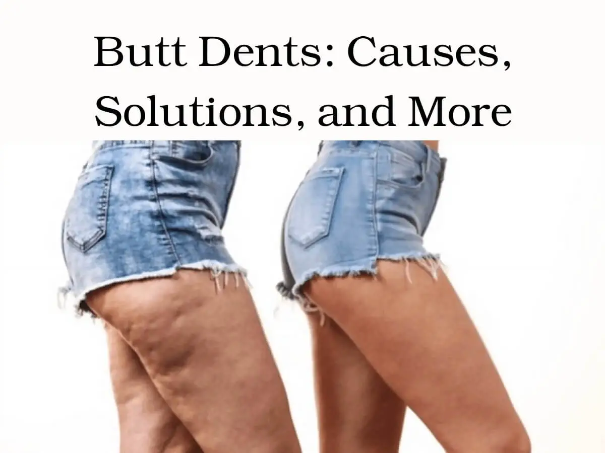 Butt Dents
