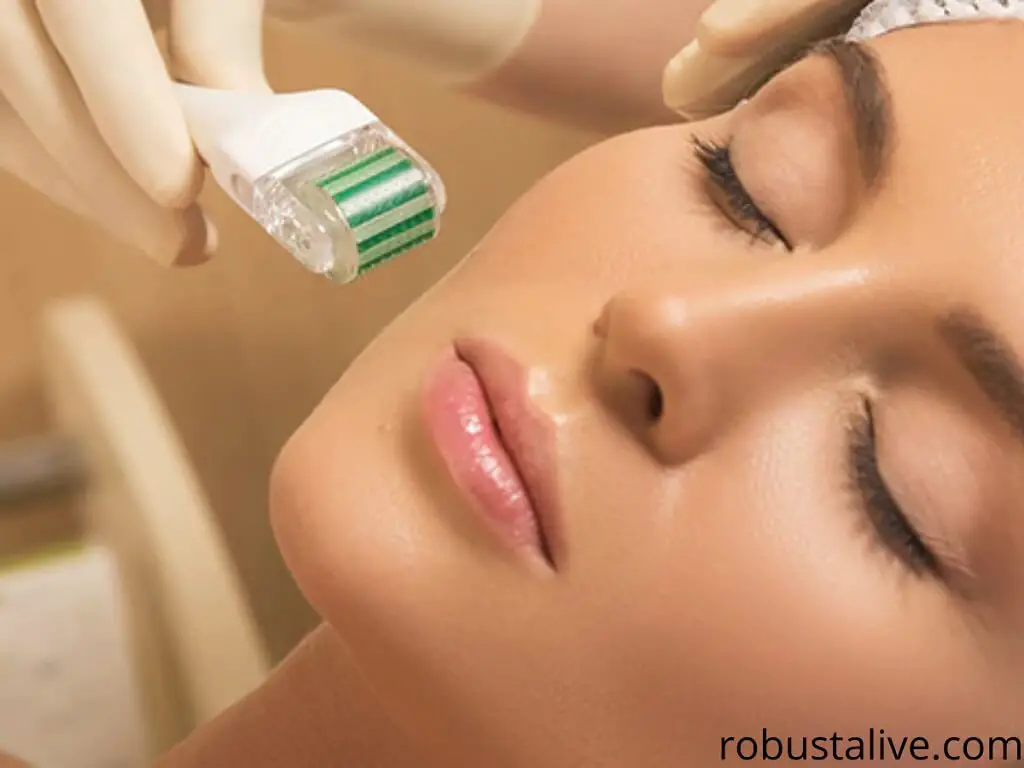 How Long Do Microneedling Results Last