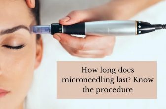 How Long Does Microneedling Last