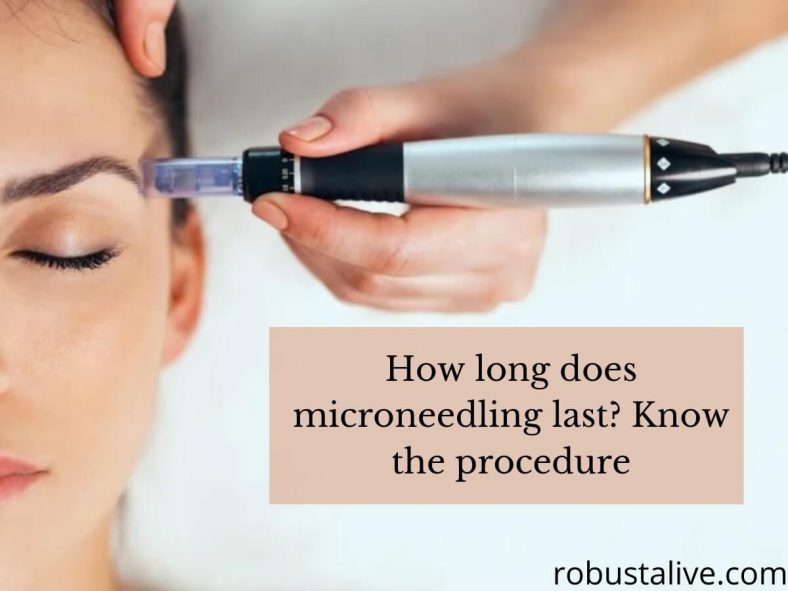 How Long Does Microneedling Last Know The Procedure