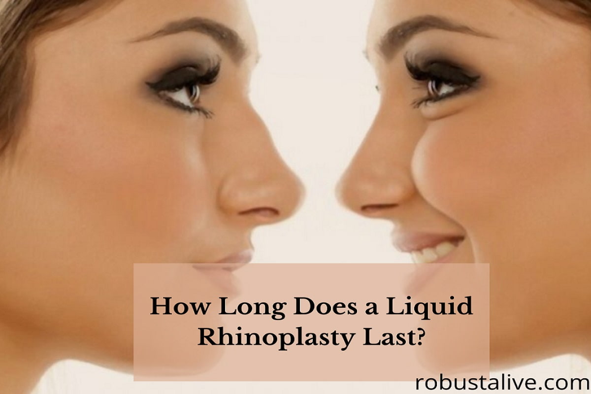 How Long Does a Liquid Rhinoplasty Last?
