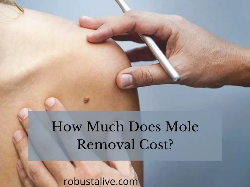 How Much Does Mole Removal Cost Robustalive