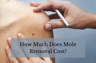 How Much Does Mole Removal Cost