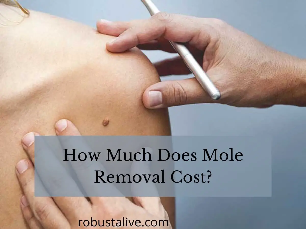 How Much Does Mole Removal Cost