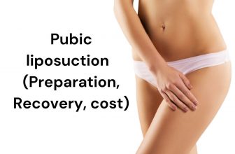 Pubic Liposuction – Preparation, Recovery, Cost