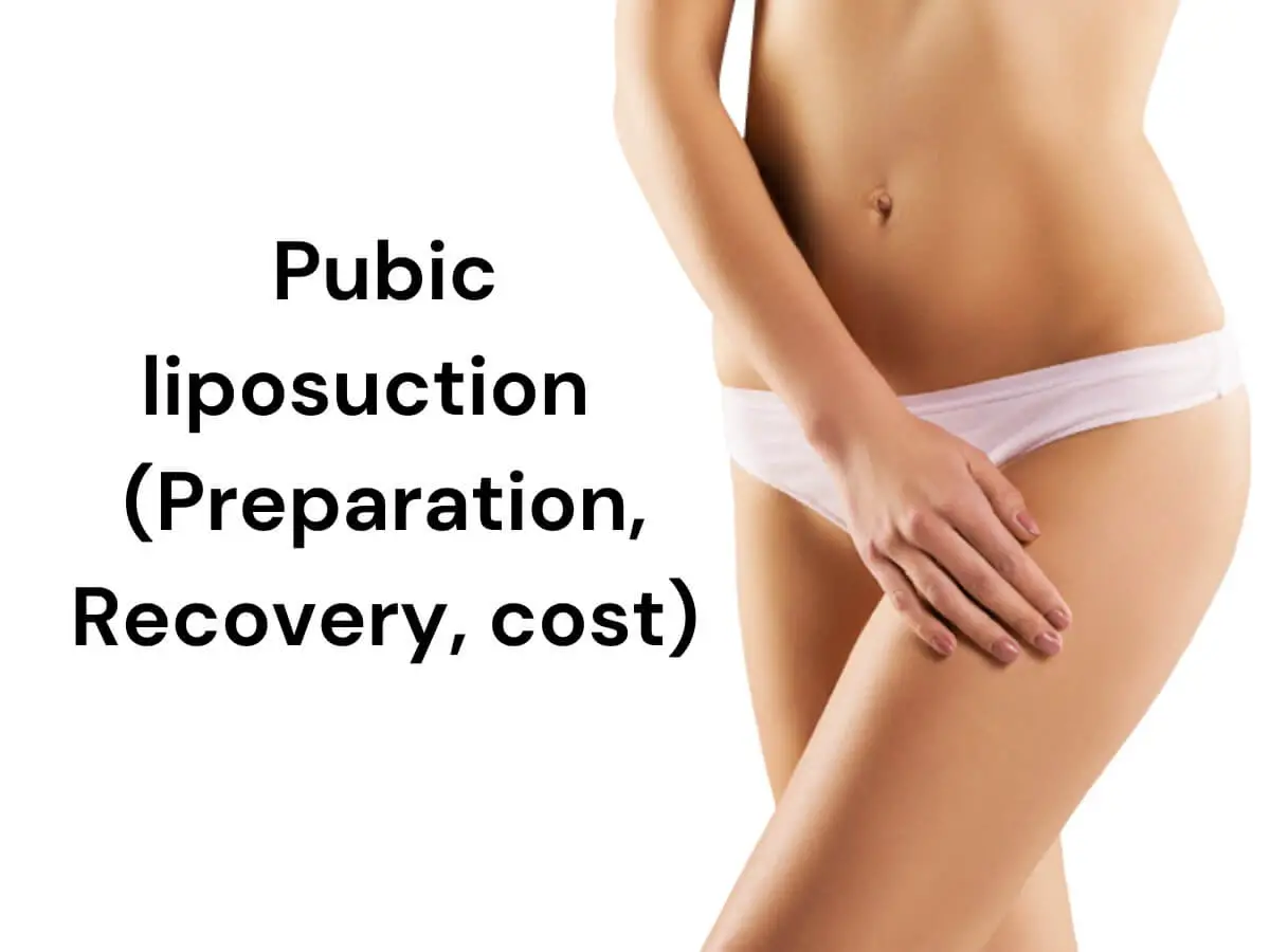Pubic Liposuction – Preparation, Recovery, Cost
