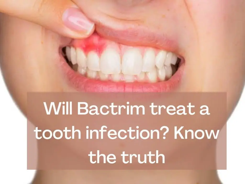 Will Bactrim treat a tooth infection Know the truth