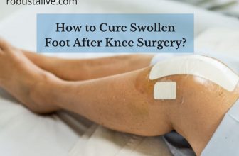 Cure Swollen Foot After Knee Surgery