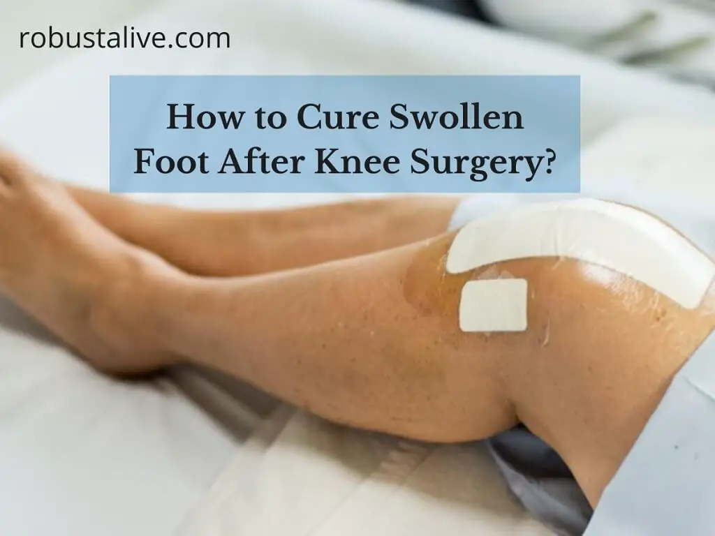 Cure Swollen Foot After Knee Surgery