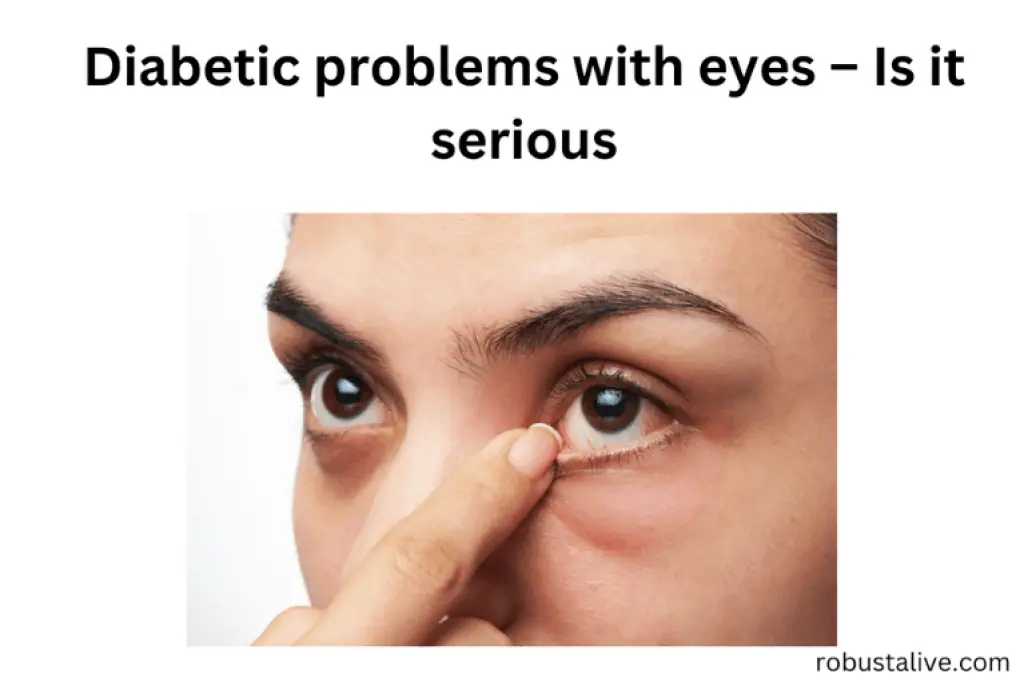 Diabetic Problems With Eyes Is It Serious? Robustalive