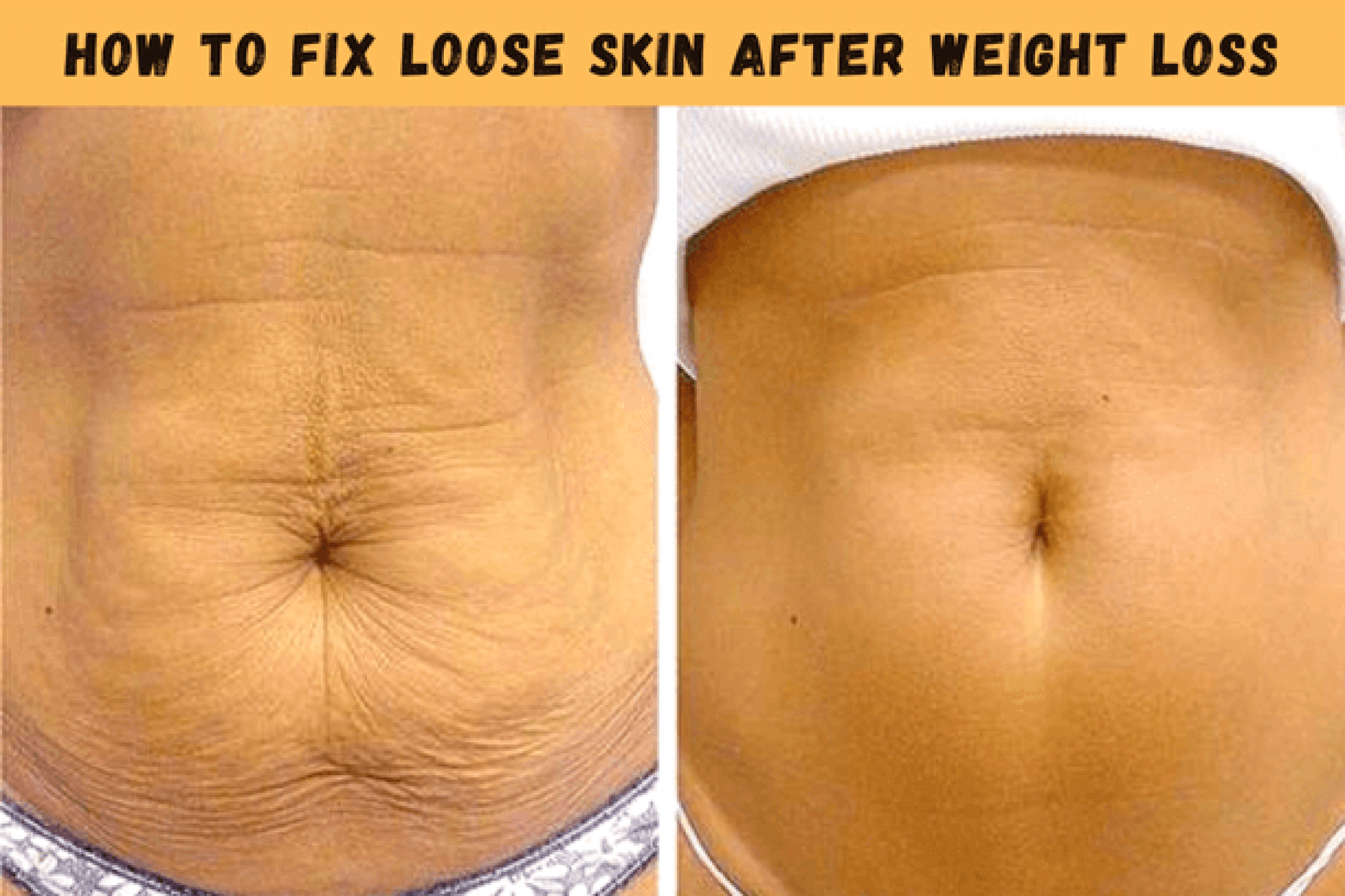 how-to-tighten-loose-skin-how-i-m-tightening-my-loose-skin-after