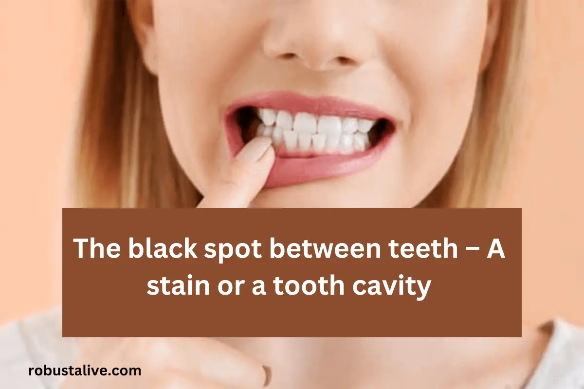 The black spot between teeth