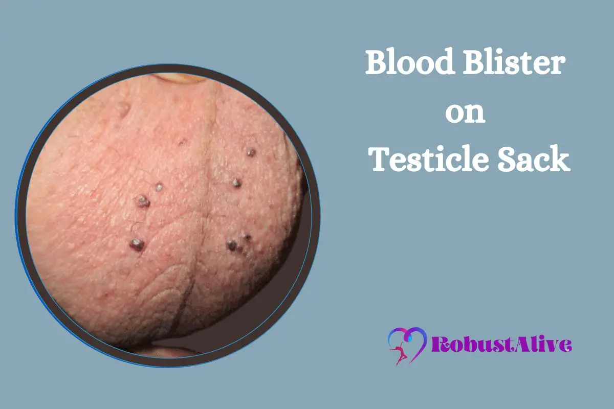 Blood Blister on Testicle Sack