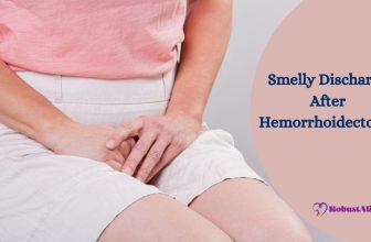 Smelly Discharge After Hemorrhoidectomy