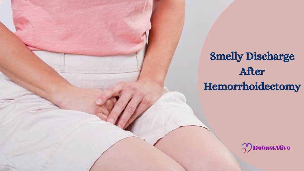 Smelly Discharge After Hemorrhoidectomy