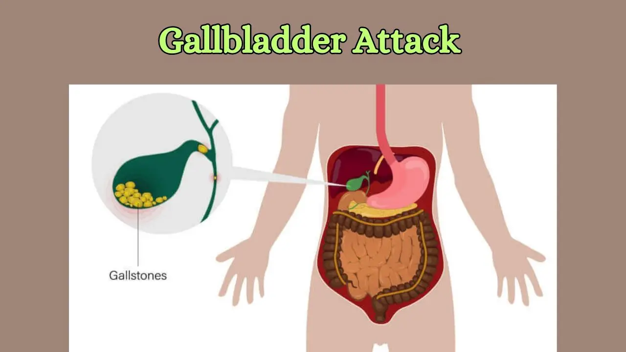 How To Stop A Gallbladder Attack While It Is Happening