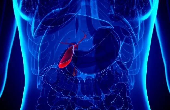 What Causes A Gallbladder Attack