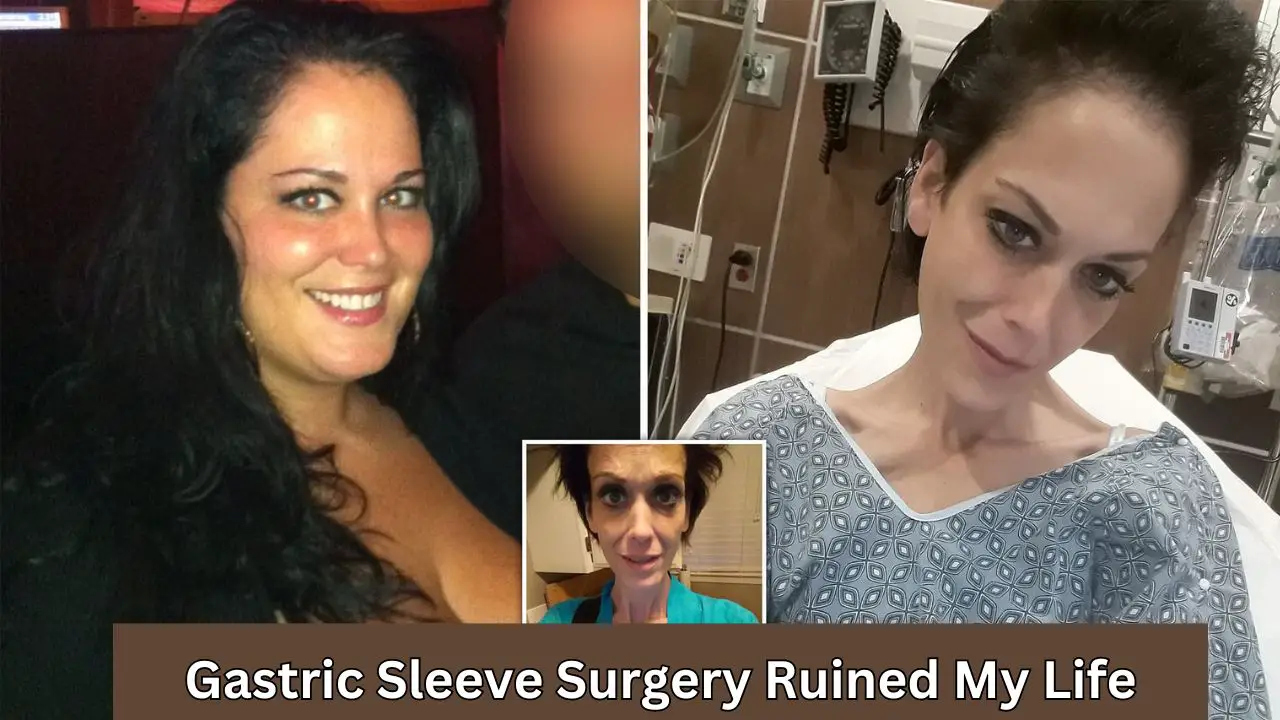 Gastric Sleeve Surgery Ruined My Life