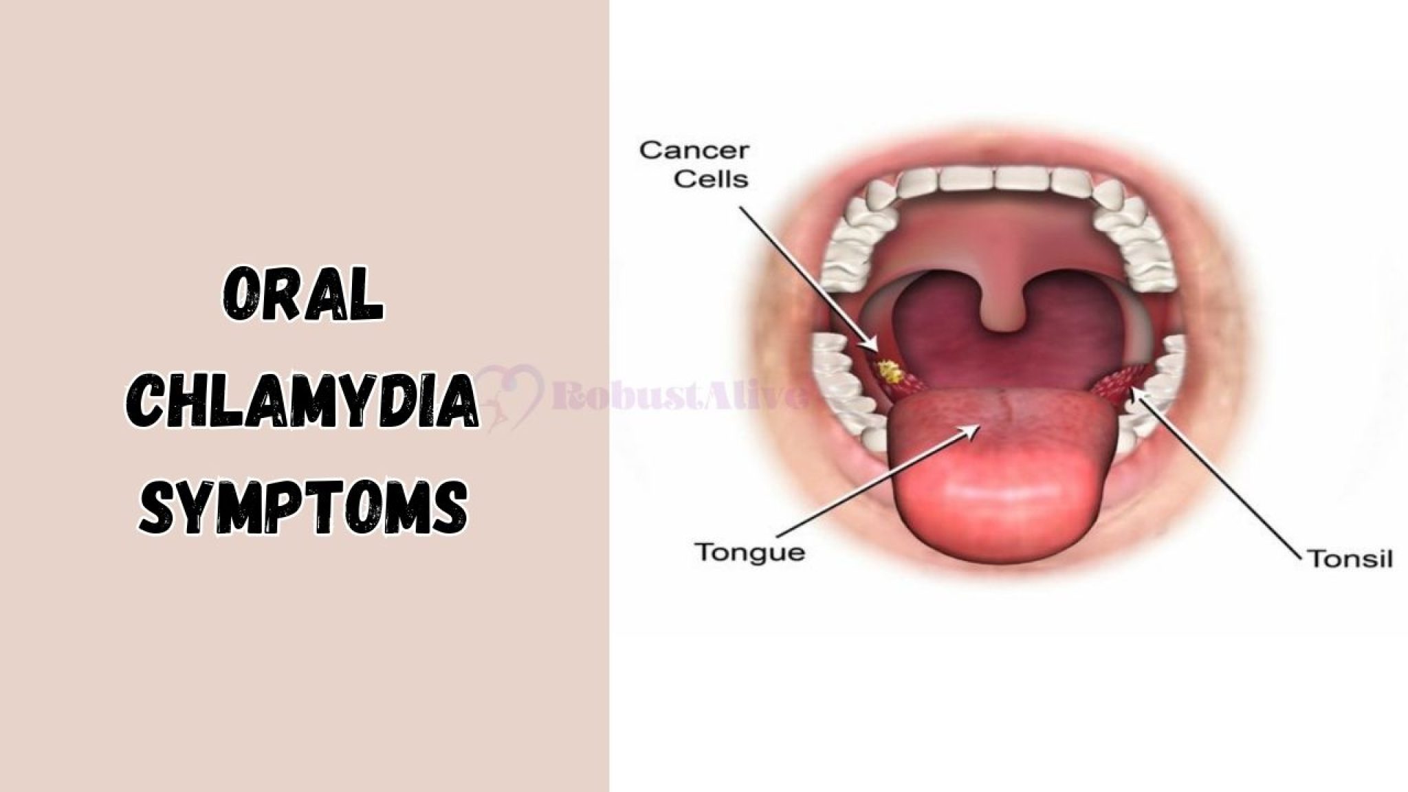 Oral Chlamydia Symptoms & Signs to Look Out For