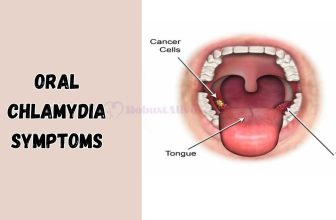 Oral Chlamydia Symptoms