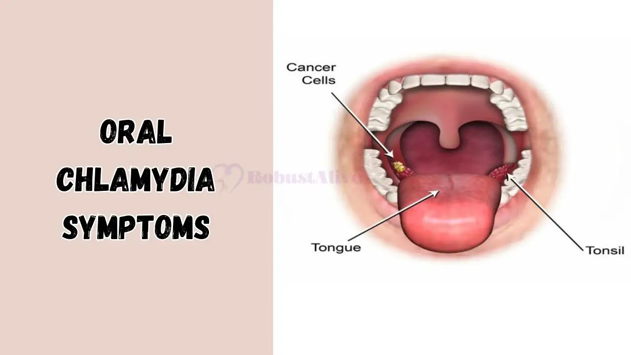 Oral Chlamydia Symptoms