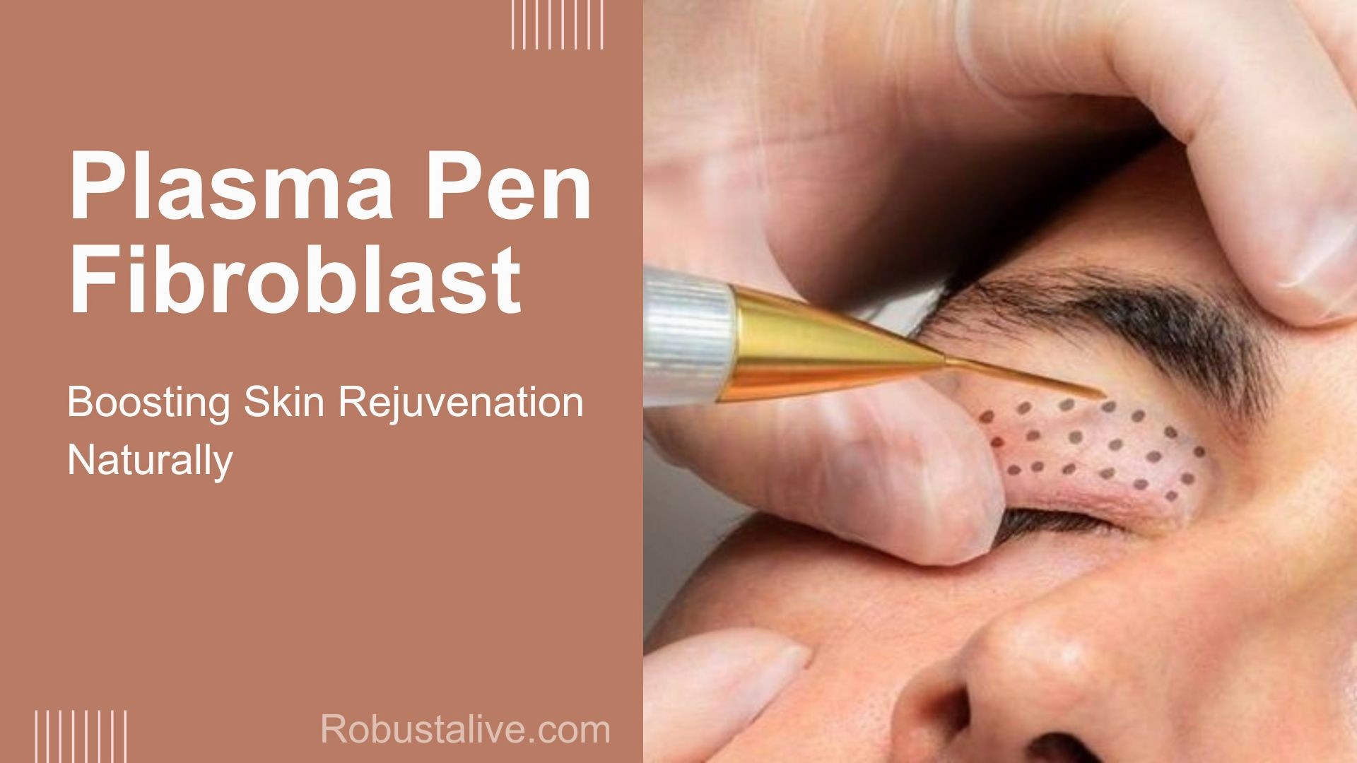 Plasma Pen Fibroblast
