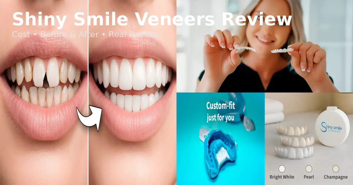 Shiny Smile Veneers review showing before and after results of snap on veneers teeth transformation