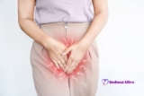 Can Acyclovir Cause Yeast Infections? Find Out the Answers