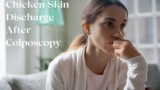 Chicken Skin Discharge after Colposcopy