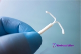 IUD Strings Longer During Period: What Causes It & How to Fix It?