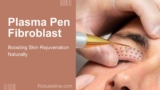 Plasma Pen Fibroblast: Boosting Skin Rejuvenation Naturally