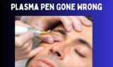 Plasma Pen Gone Wrong – Problems, Causes & Solutions