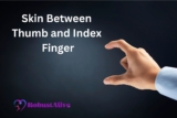 Skin Between Thumb and Index Finger: What Causes Itching, Swelling & Peeling and Remedies?