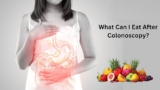 What Can I Eat After Colonoscopy? Learn Complete Dietary Guidance